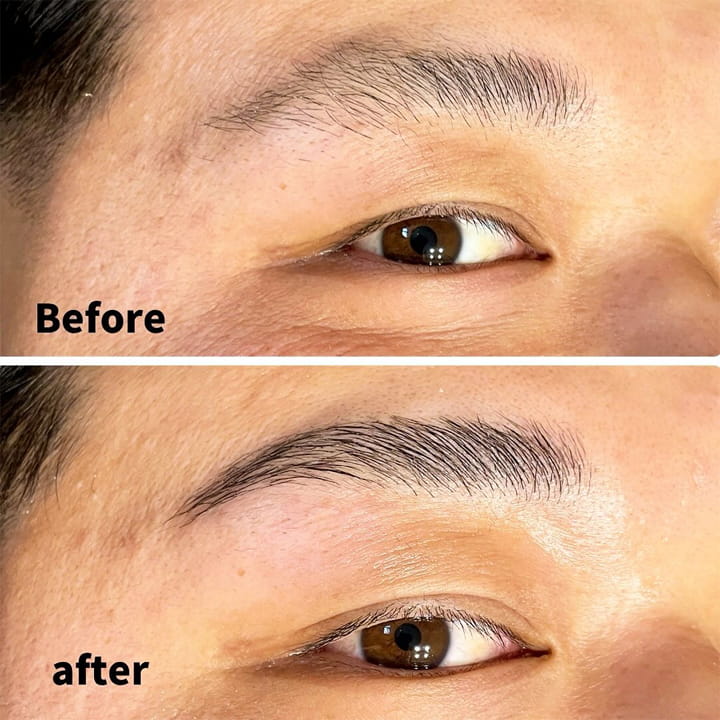 ハリウッドブロウリフト｜メンズ｜脱毛サロン福岡｜T’s Salon｜ティーズサロン